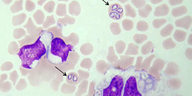 Babesia Vogeli